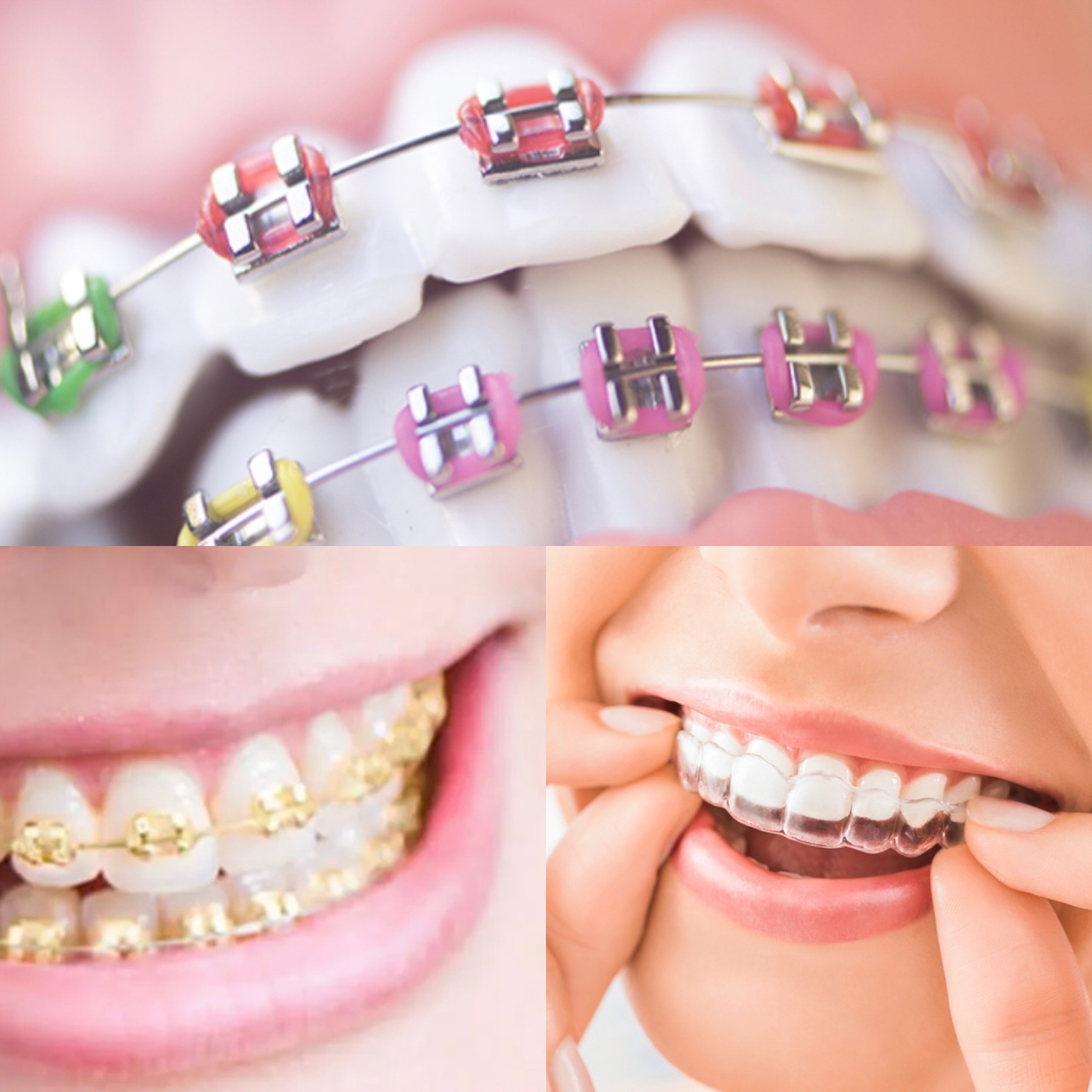 General & Pediatric Dentist Buffalo NY Area Winning Smiles